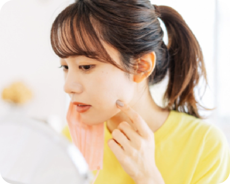 ニキビ・ニキビ跡